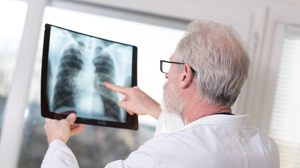 Bild Arzt begutachtet Röntgen von Lunge