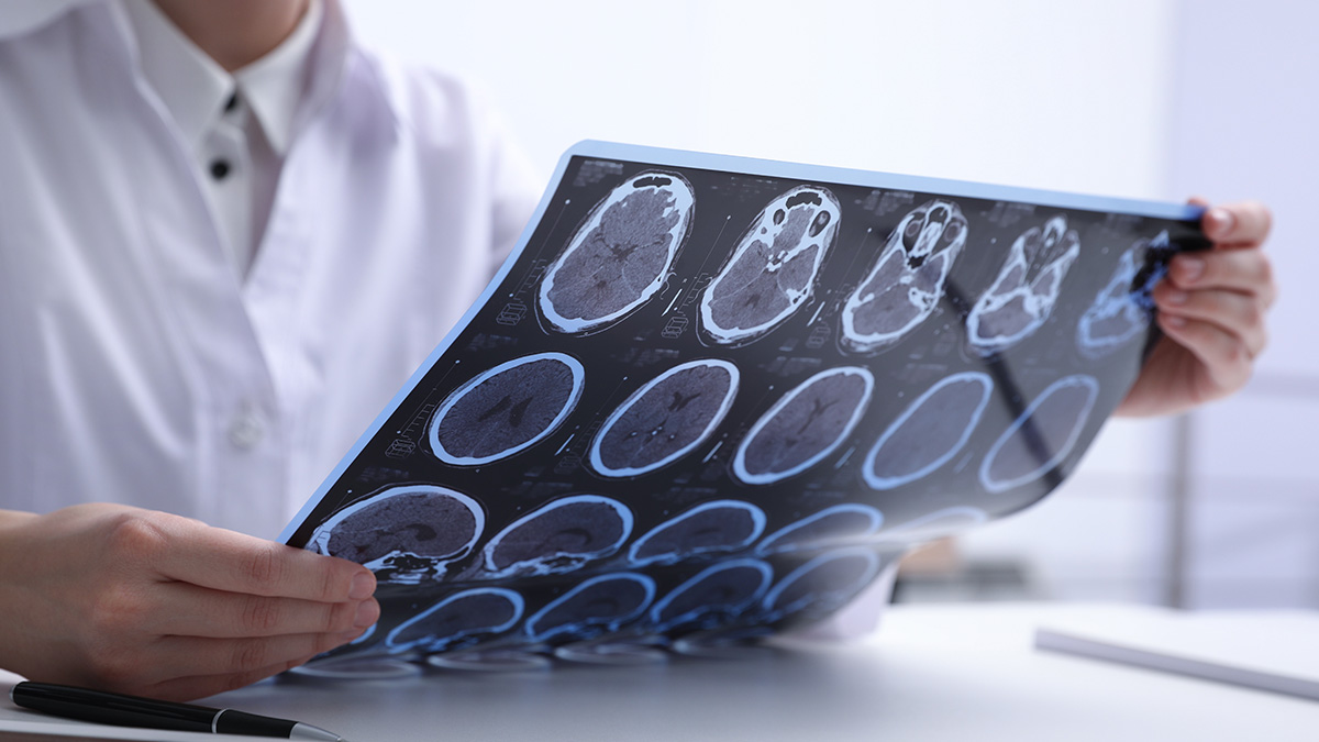 Bild Arzt begutachtet CT-Aufnahmen von Gehirn